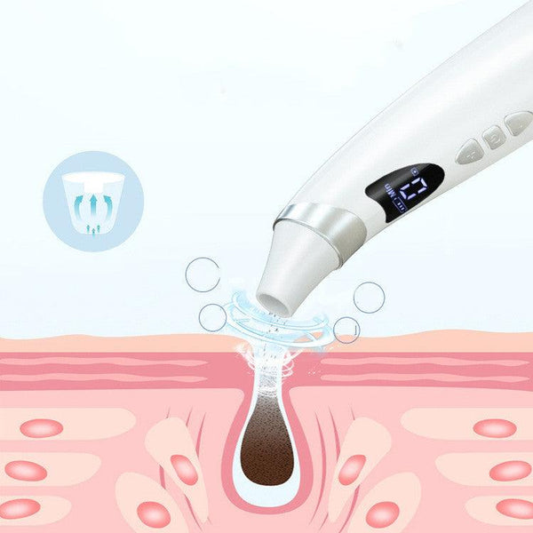 Electric Visual Blackhead Suction Instrument Household Cleansing Pore Cleaner For Skin Equipment Skin Care Tool - Amazitshop