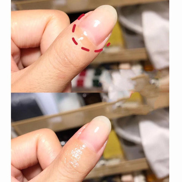 Nourishing Pen Nail Oil Anti - breakage Nourishing Edge - Amazitshop